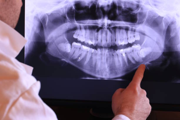 Best Emergency Tooth Extraction in Brookland, AR