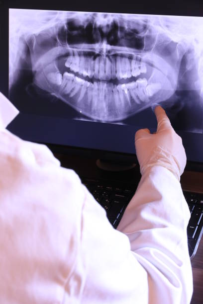 Best Emergency Wisdom Teeth Removal in Brookland, AR